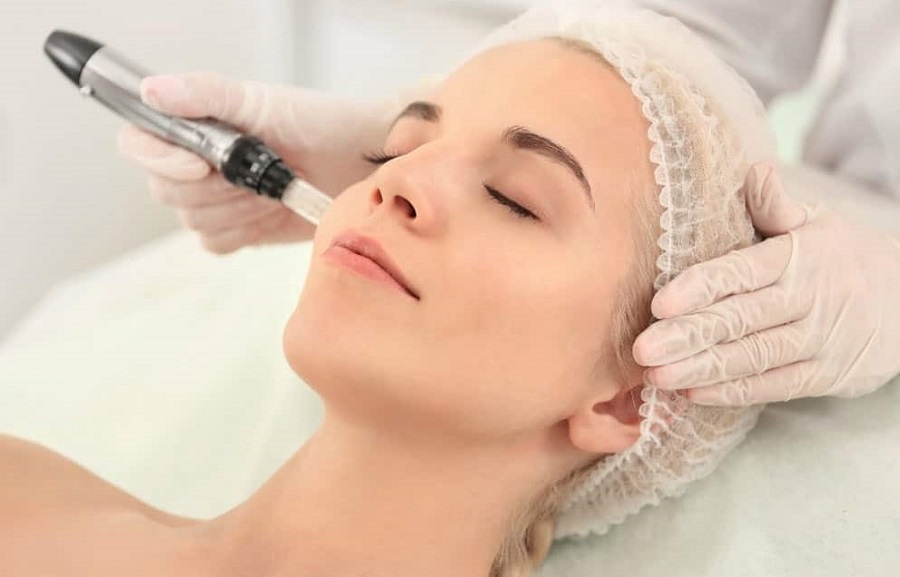 dermapen-microneedling