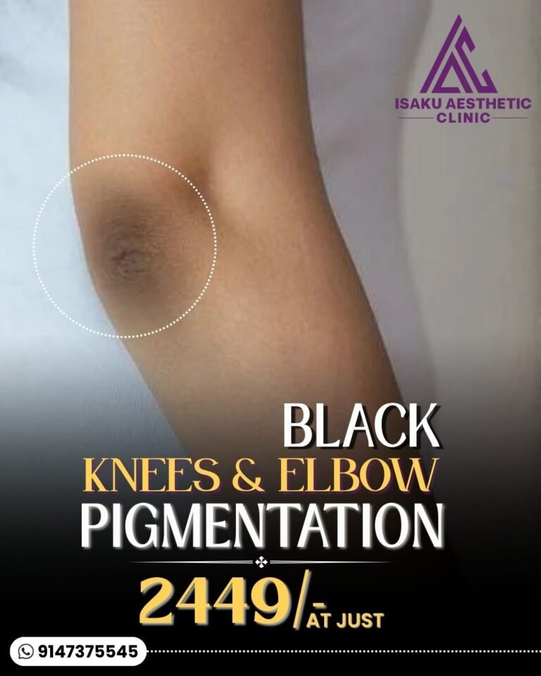 Black Knees and Elbow Pigmentation - Isaku Aesthetic Clinic Kolkata
