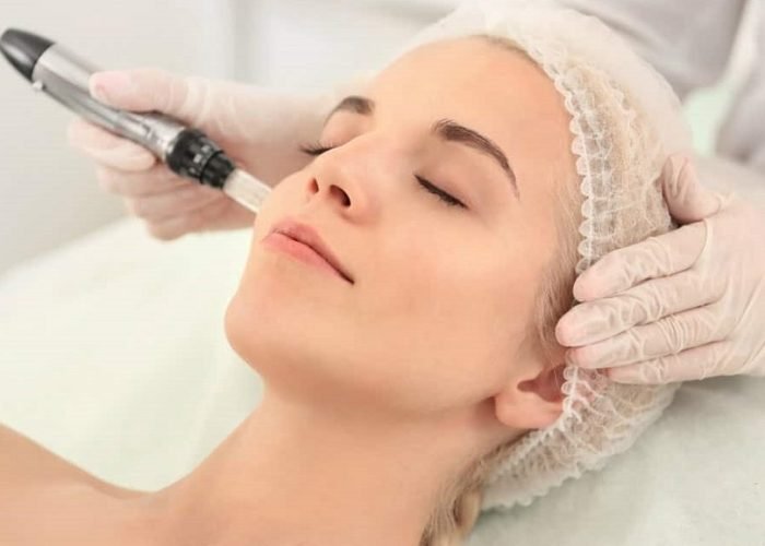 dermapen-microneedling